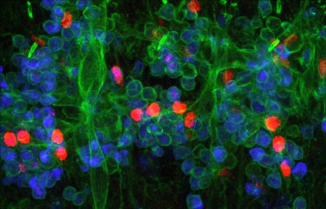 Light Sheet Fluorescence Microscopy